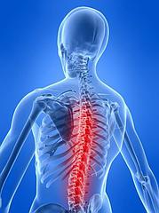 Un molesto dolor de espalda puede ser tratado con la quiropraxia